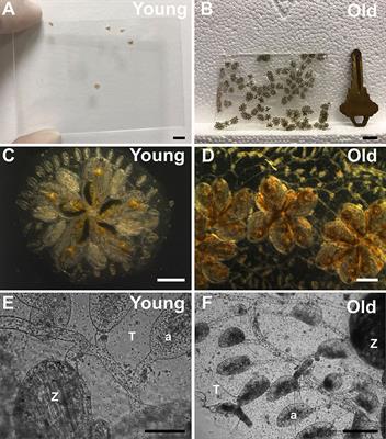 Vascular Aging in the Invertebrate Chordate, Botryllus schlosseri